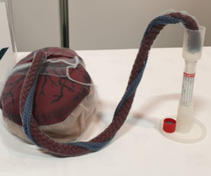 The Umbifunnel cord blood collection technology