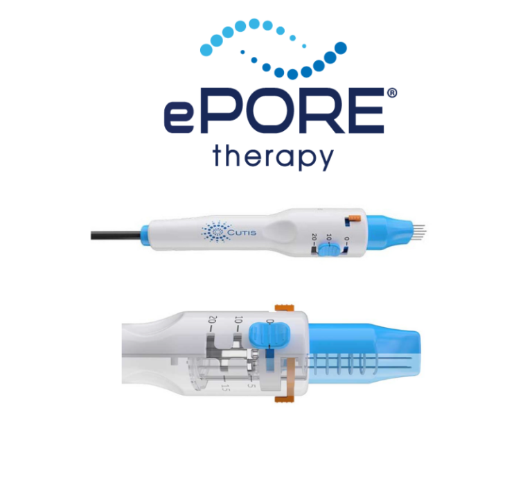 Mirai Medical ePore technology